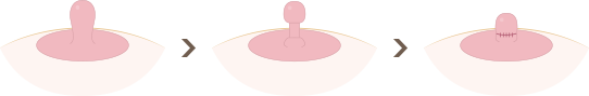 img2