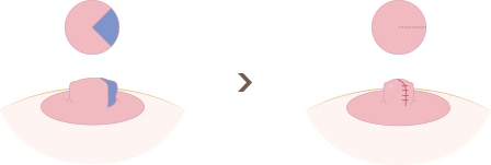 img3